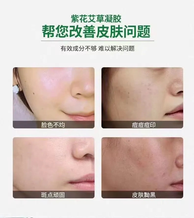 Herbal Skin Repair Gel